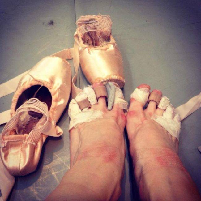 Well, 6 hours of rehearsals will do wonders for your feet.