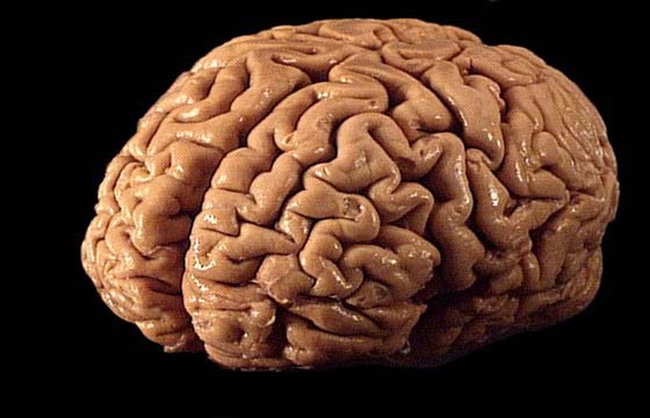 13. The human brain is much more active at night than during the day.