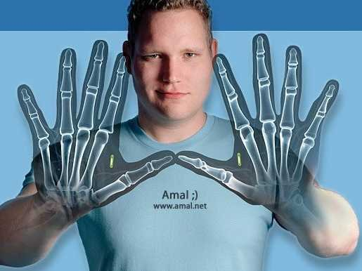 2.) Amal Graafstra has RFID chips implanted in his hands. He's programmed the chips to do a few different things for him like unlocking his car, and home. He also runs a company that sells DIY chip implants.