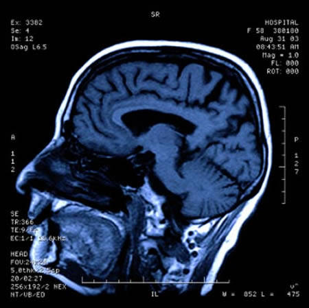 Electrodes wake a man after 6 years