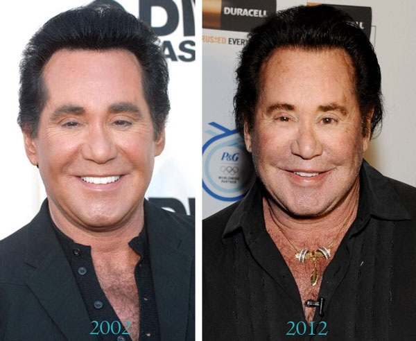 2.) Vegas living has done nothing good for Wayne Newton.