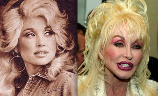 8.) Dolly Parton might be more plastic than human at this point.