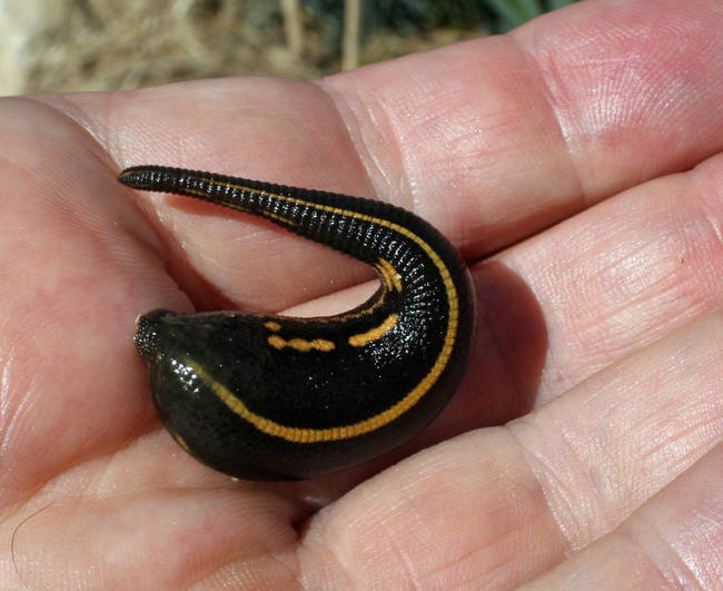 Leeches were used as common practice to remove blood before surgery.