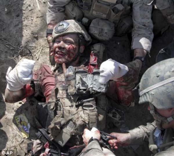 Marine Gunnery Sgt. Brian Meyer smiles for a picture by another Marine while waiting to be evacuated after a bomb he was trying to deactivate exploded in Afghanistan. Meyer lost his right leg above the knee, his right hand above the wrist, and three fingers on his left hand in the incident.