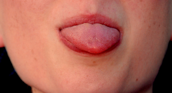 1.) Sticking Out Tongue - Tibet