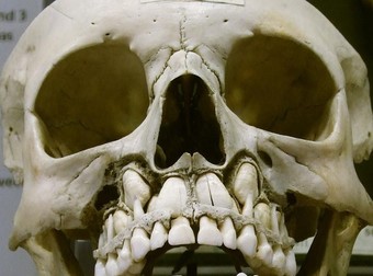 This Is What Your Skull Looks Like Before Losing Baby Teeth…It Is Horrifying