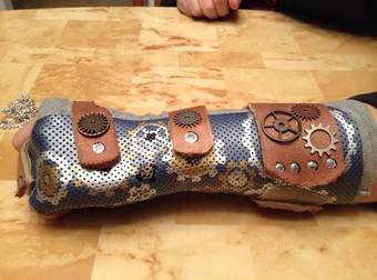 Broken Bones Get A Little Less Terrible Thanks To Decorated Casts