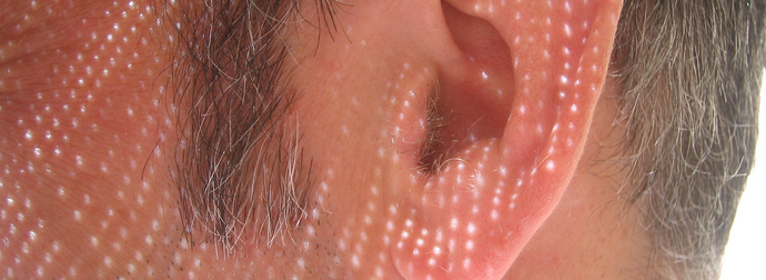 What Doctors Found In This Guy’s Ear Will Give You Nightmares Forever. NOPE.