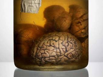 What This Artist Did With Preserved Human Brains Is Morbidly Beautiful