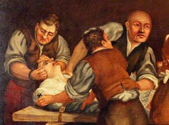 These 14 Deadly Facts About Victorian Surgery Will Shock You