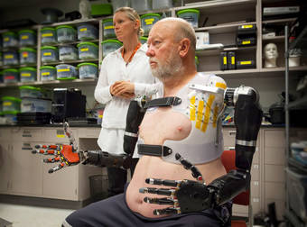 This Man Lived Without Arms For 40 Years, And Now He Has New Ones